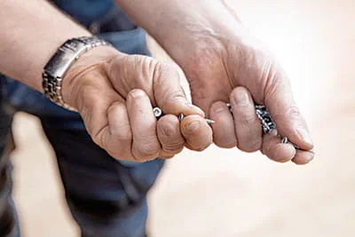 Der Handwerker Johannes Feldhoff mit einer Schnittverletzung